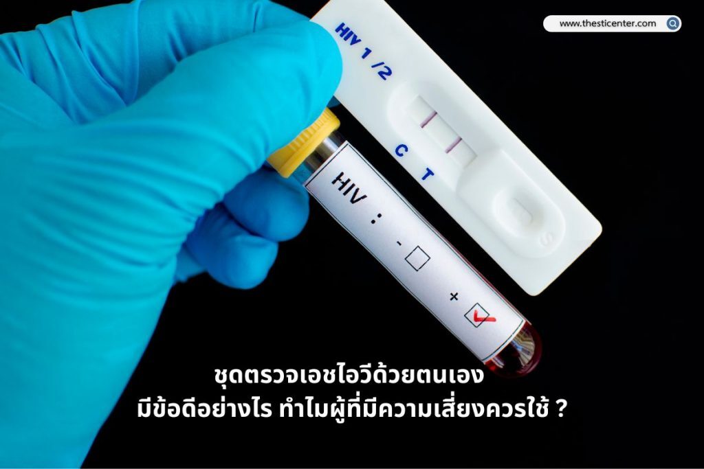 ชุดตรวจเอชไอวีด้วยตนเอง มีข้อดีอย่างไร ทำไมผู้ที่มีความเสี่ยงควรใช้ ?