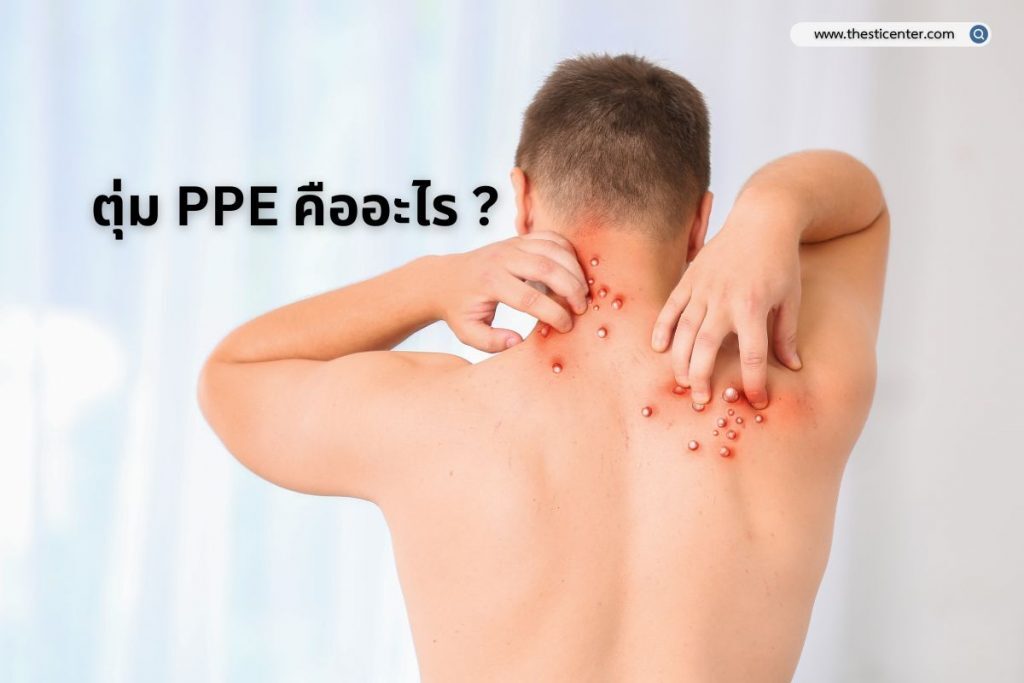 ตุ่ม PPE คืออะไร ?