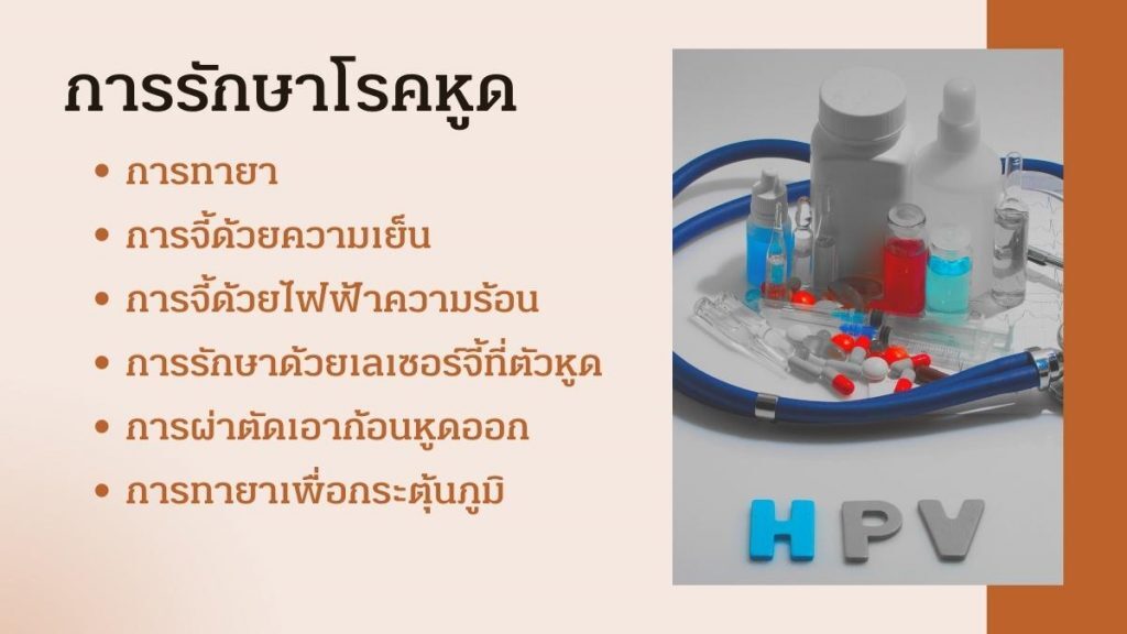 การรักษาโรคหูด