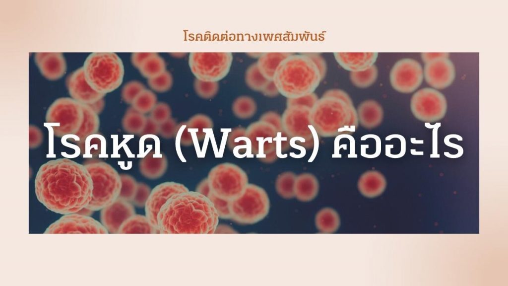 โรคหูด (Warts) คืออะไร