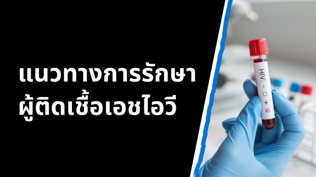 แนวทางการรักษาผู้ติดเชื้อเอชไอวี/โรคเอดส์