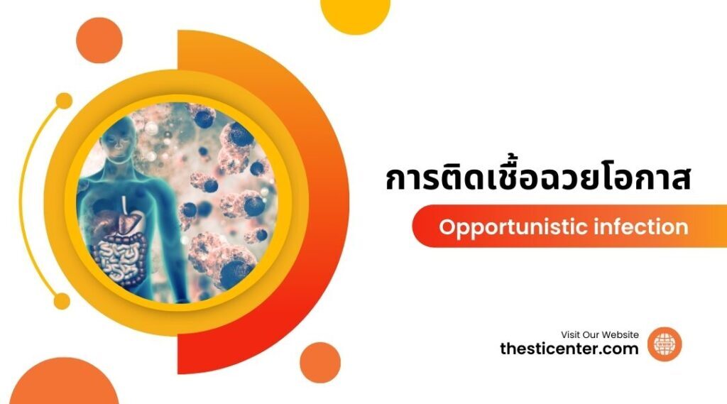 การติดเชื้อฉวยโอกาส | Opportunistic infection