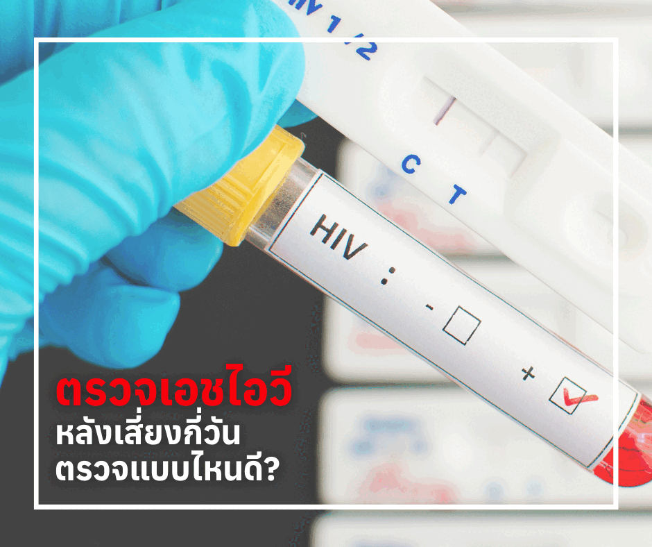 ตรวจเอชไอวีหลังเสี่ยงกี่วัน ตรวจแบบไหนดี