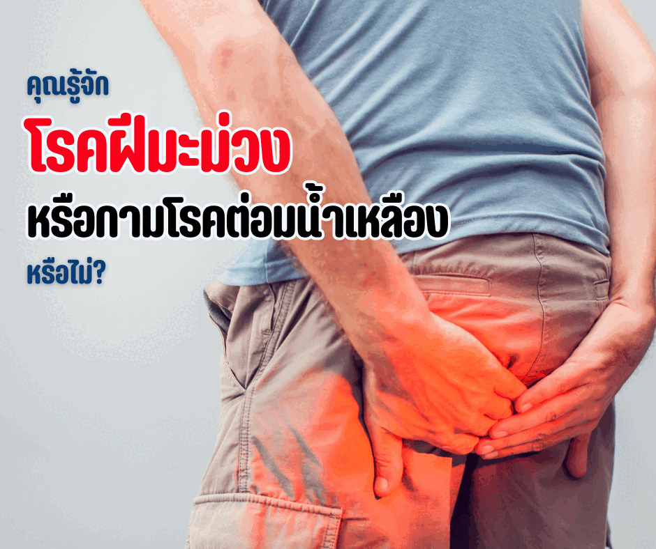 คุณรู้จักโรคฝีมะม่วง หรือกามโรคต่อมน้ำเหลือง หรือไม่?