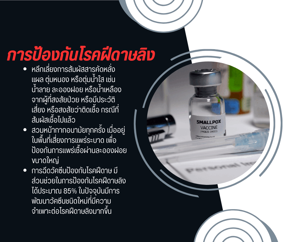 การป้องกันโรคฝีดาษลิง