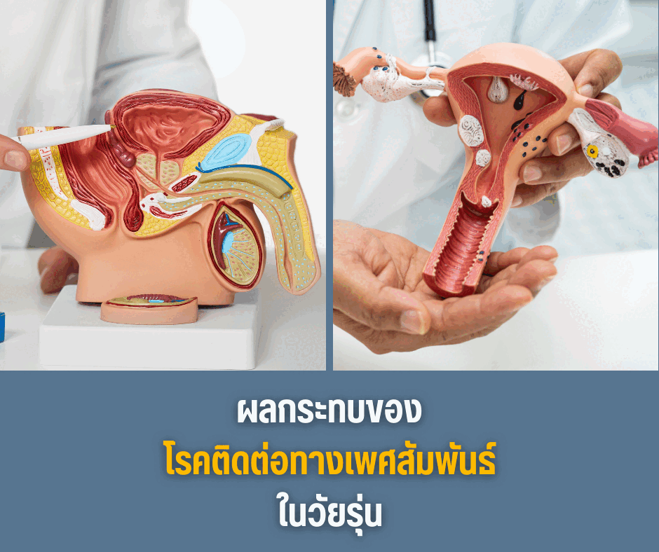 ผลกระทบของโรคติดต่อทางเพศสัมพันธ์ในวัยรุ่น