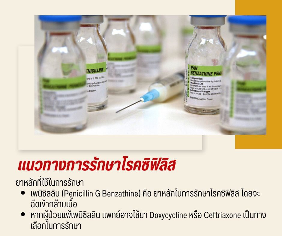 แนวทางการรักษาโรคซิฟิลิส