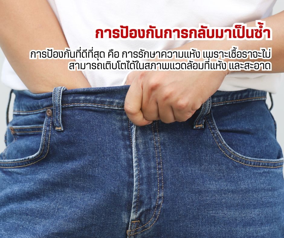 การป้องกันการกลับมาเป็นซ้ำ
