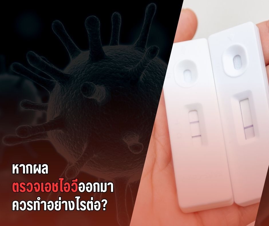 หากผลตรวจเอชไอวีออกมา ควรทำอย่างไรต่อ