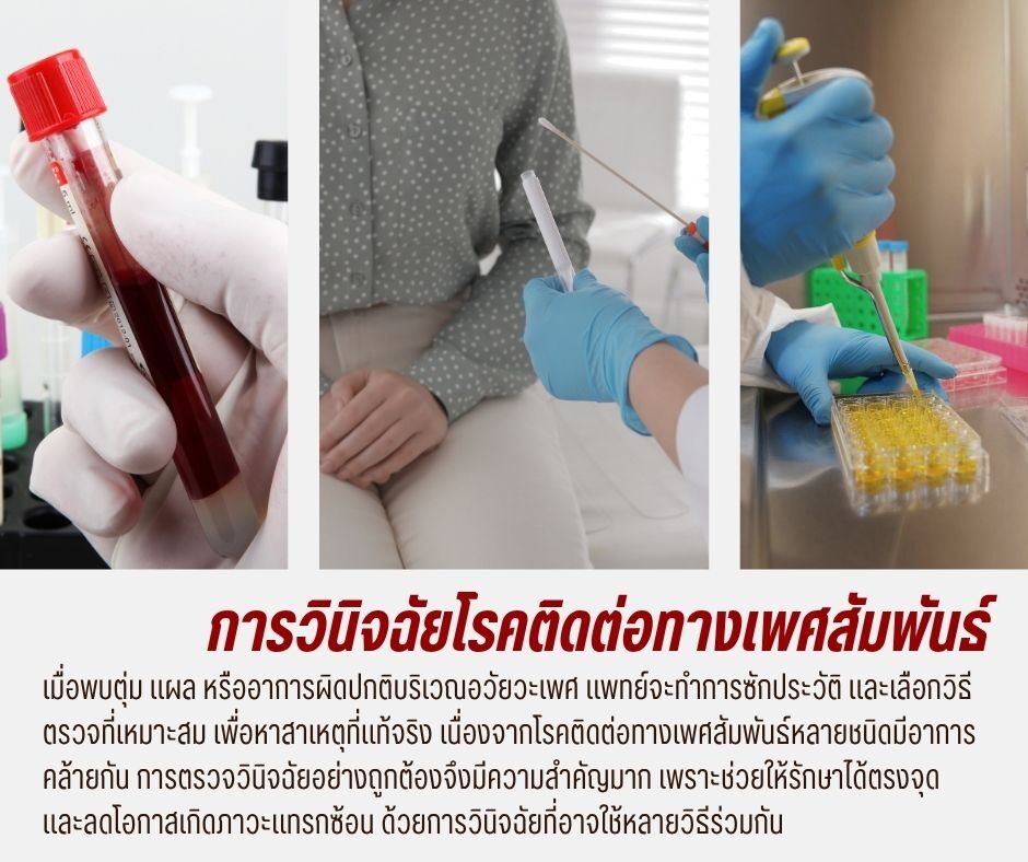 การวินิจฉัยโรคติดต่อทางเพศสัมพันธ์