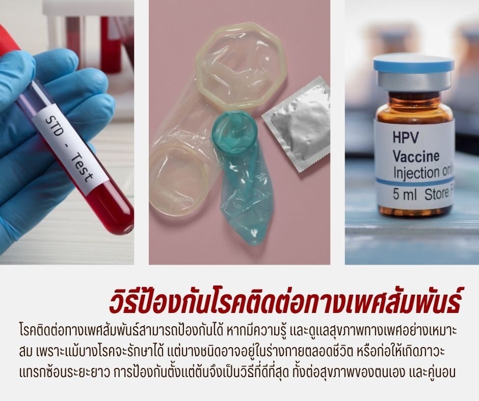 วิธีป้องกันโรคติดต่อทางเพศสัมพันธ์