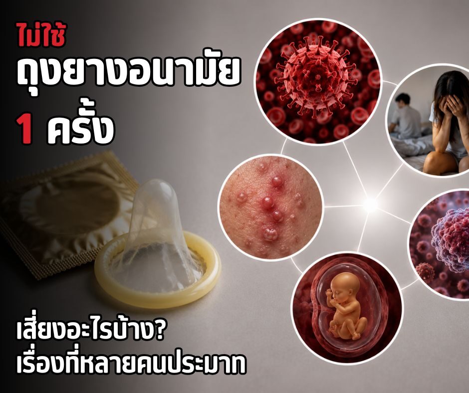 ไม่ใช้ถุงยางอนามัย 1 ครั้ง เสี่ยงอะไรบ้าง? เรื่องที่หลายคนประมาท