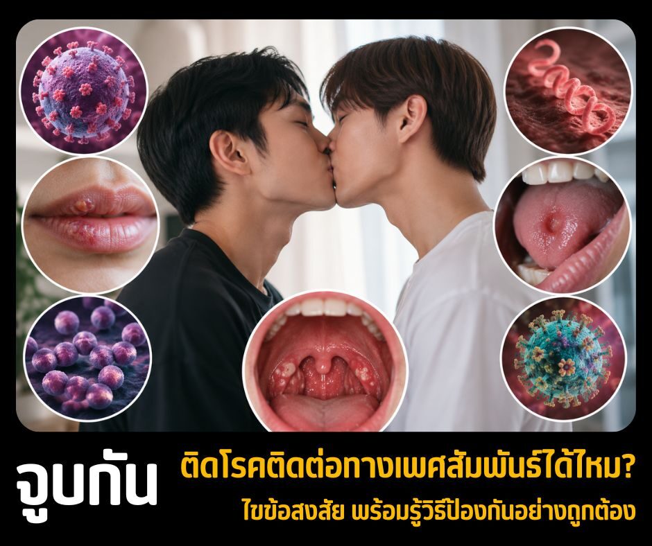 จูบกัน ติดโรคติดต่อทางเพศสัมพันธ์ได้ไหม? ไขข้อสงสัย พร้อมรู้วิธีป้องกันอย่างถูกต้อง