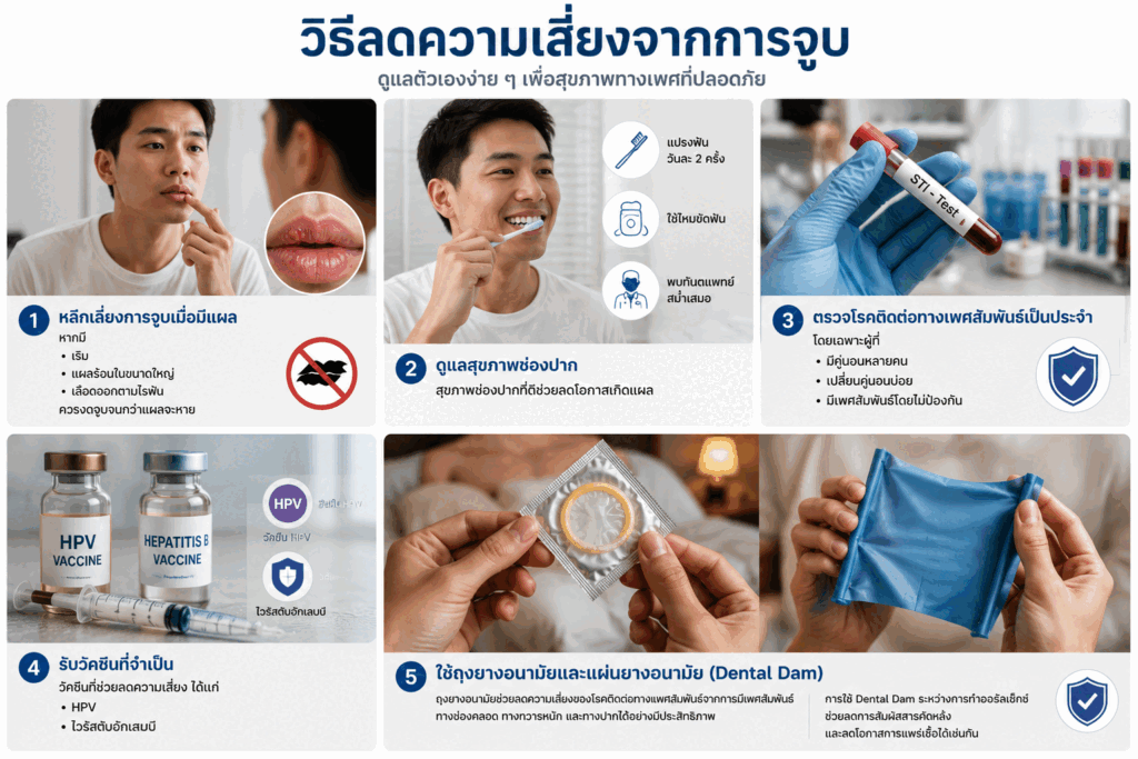วิธีลดความเสี่ยงจากการจูบ