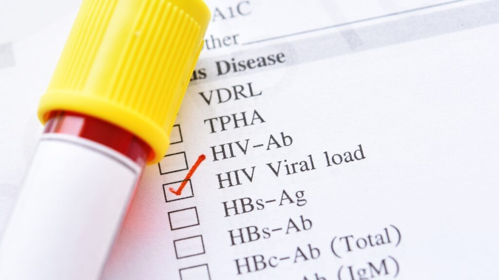 การรับรู้และปรับตัวตามอาการของร่างกาย HIV Viral Load