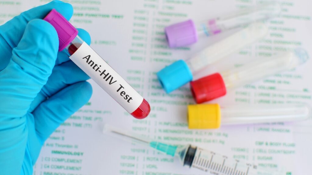 ตรวจไม่เจอเชื้อ หมายความว่าหายจาก HIV แล้วจริงไหม?