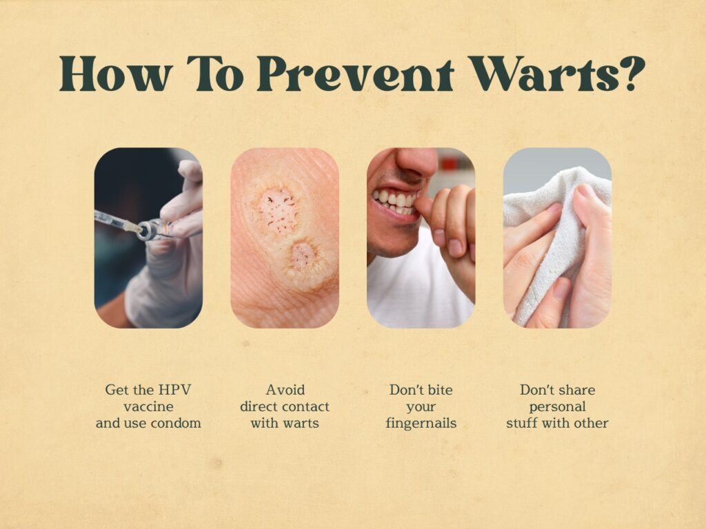 How To Prevent Warts