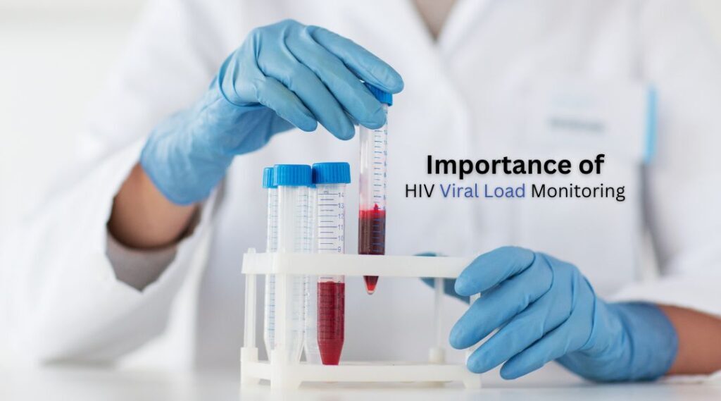 Understanding HIV Viral Load: Importance, Testing, and Treatment